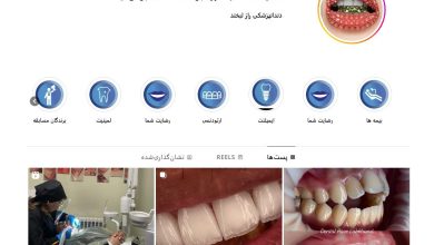 دندانپزشکی راز لبخند