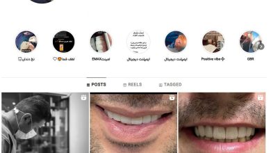 مطب دندانپزشکی دکتر پیمان کنز