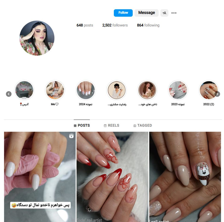 کاشت ناخن فردیس (Fardis Nail)