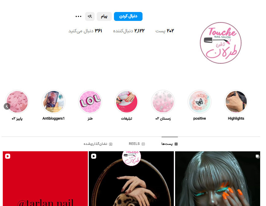 کاشت ناخن طرلان